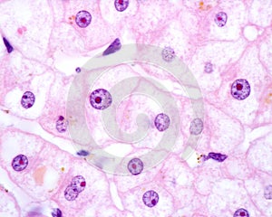 Human hepatocyte. Nucleolus