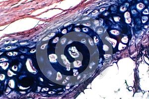 Human hyaline cartilage bone under microscope view for education pathology