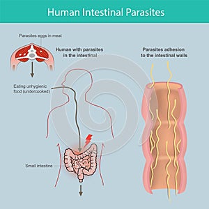 Human Intestinal Parasites.