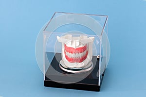 Human jaw with teeth implants anatomy model isolated on blue background in a glass box.