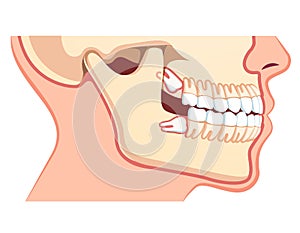 Human jaws model with teeth row. Dentistry