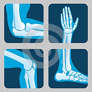 Human joints, knee and elbow, ankle wrist. Medical orthopedic vector set