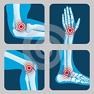 Human joints with pain rings. Arthritis and rheumatism infographic. Medical app vector buttons