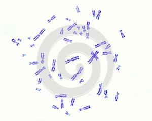 Human karyotype. Chormosomes