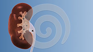 Human kidney stones medical background