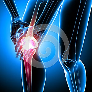 Human knee pain