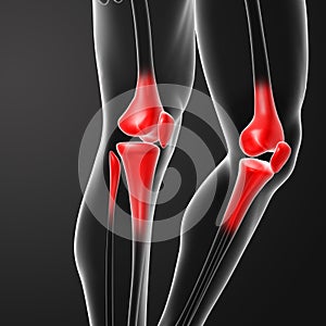 Human knee pain