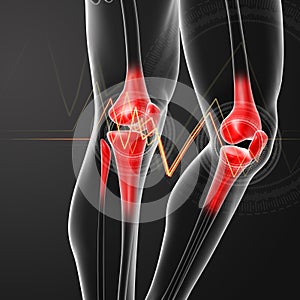 Human knee pain with the anatomy of a leg