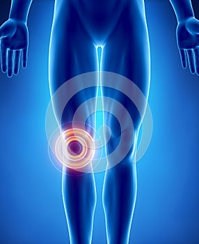 Human knee problem with highlighted area