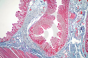 Human large intestine tissue under microscope view.