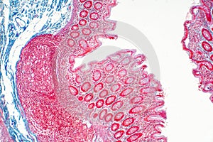 Human large intestine tissue under microscope view