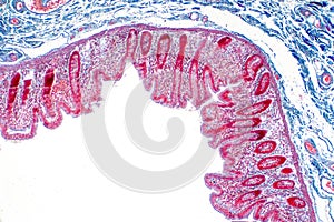 Human large intestine tissue under microscope view