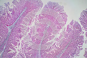 Human large intestine tissue under microscope view