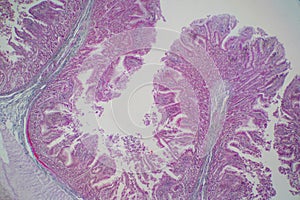 Human large intestine tissue under microscope view.