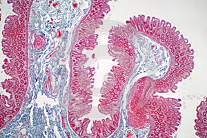 Human large intestine tissue under microscope view.