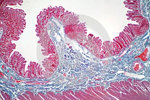 Human large intestine tissue under microscope view. photo