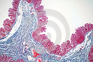 Human large intestine tissue under microscope view.