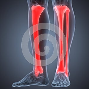 Human Leg Joint Pains (Tibia and Fibula joints)