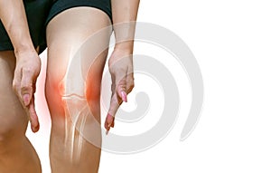 Human leg Osteoarthritis inflammation bone joints
