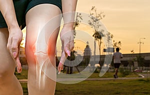 Human leg Osteoarthritis inflammation bone joints photo
