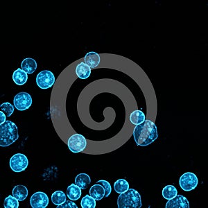 Human leukemic cells