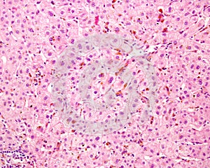 Human liver. Cholestasis photo