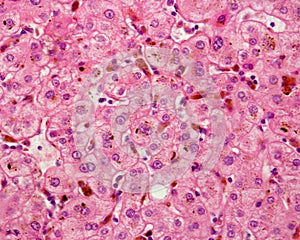 Human liver. Cholestasis photo