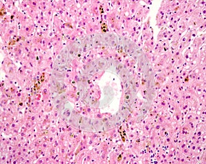 Human liver. Cholestasis photo