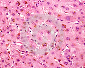 Human liver. Cholestasis photo