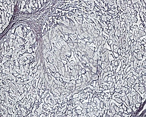 Human liver. Cirrhosis. Silver stain