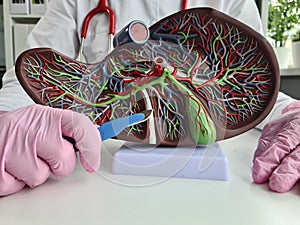 Human liver model fibrous cirrhotic and cancerous photo