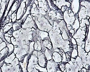 Human liver. Reticular fibers photo