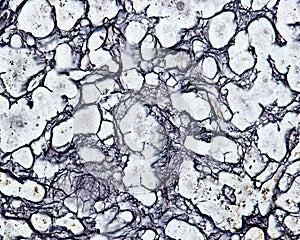 Human liver. Reticular fibers photo