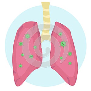 Human lungs affected by viral microorganisms