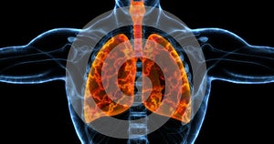 Human lungs medical illustration showing infected lungs in bright orange.