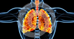 Human lungs medical illustration showing infected lungs in bright orange. photo