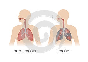 Human lungs photo