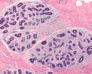 Human mamary gland. TDLU
