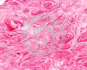 Human mammary gland. Breast stroma