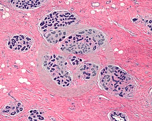 Human mammary gland. TDLU