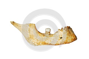 Human mandible