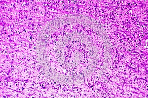 Human medulla oblongata