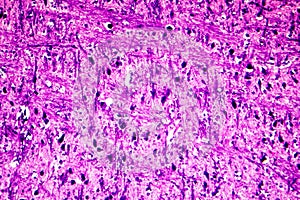 Human medulla oblongata