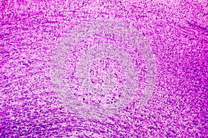 Human medulla oblongata