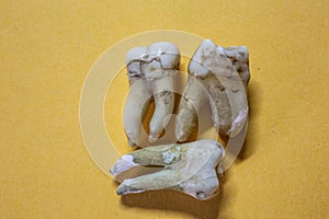 Human molars with tooth roots