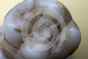 human molars with tooth roots