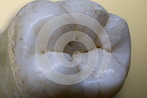 human molars with tooth roots