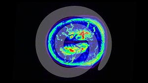 Human MRI brain scan on black background. Computed tomography of the human brai