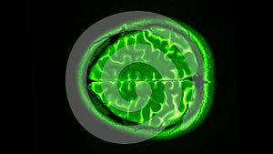 Human MRI brain scan on black background. Computed tomography of the human brai