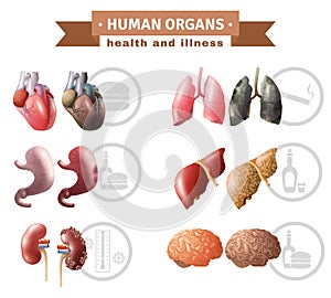 Human Organs Heath Risks Medical Poster